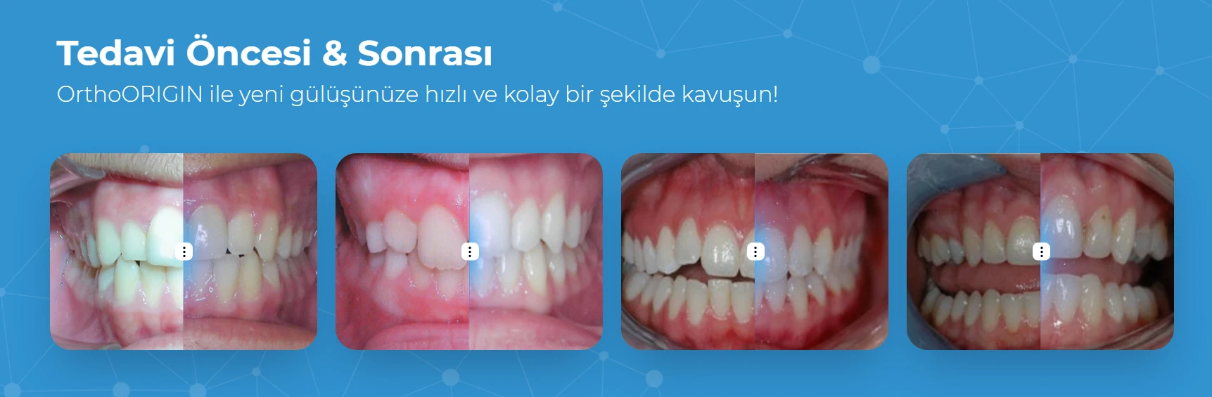 Tedavi Öncesi ve Sonrası